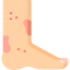 Acne Scars Specialist in Faridabad